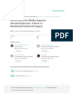 Amsa (Anterior Middle Superior Alveolar) Injection: A Boon To Maxillaryperiodontal Surgery