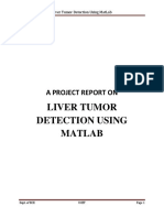 Liver Tumor Detection Using Matlab: A Project Report On