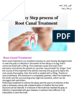 Steps of Endodontic Treatment