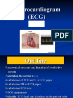 Electrocardiogram