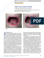 Candida-Associated Cheilitis: Online Images in The Medical Sciences