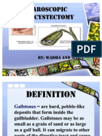 Laparoscopic Cholecystectomy