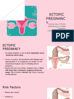 Ectopic Pregnancy