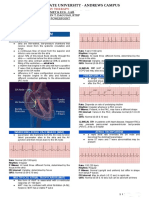 Atrial-Rhythm 230518 191520-1