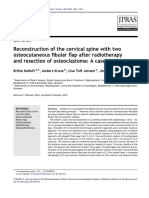 Reconstruction of The Cervical Spine With Two Osteocutaneous Fibular Flap After Radiotherapy and Resection of Osteoclastoma - A Case Report