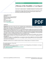 Juvenile Ossifying Fibroma of The Mandible: A Case Report