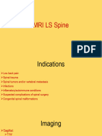 Mri Ls Spine