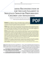 Physeal Sparing Reconstruction of The Anterior Cruciate Ligament in Skeletally Immature Prepubescent Children and Adolescents