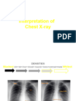 Chest X-Ray Interpretation