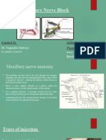 Maxillary Nerve Block