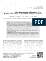 Minimally Invasive Plate Osteosynthesis (MIPO) in Diaphyseal Humerus and Proximal Humerus Fractures