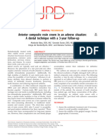 2019 Anterior Composite Resin Crown in An Adverse Situation - A Dental Technique With 3-Year Follow-Up