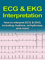 ECG & EKG Interpretation: How to interpret ECG & EKG, including rhythms, arrhythmias, and more!