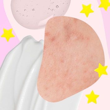 How to get rid of acne scars, according to skin experts