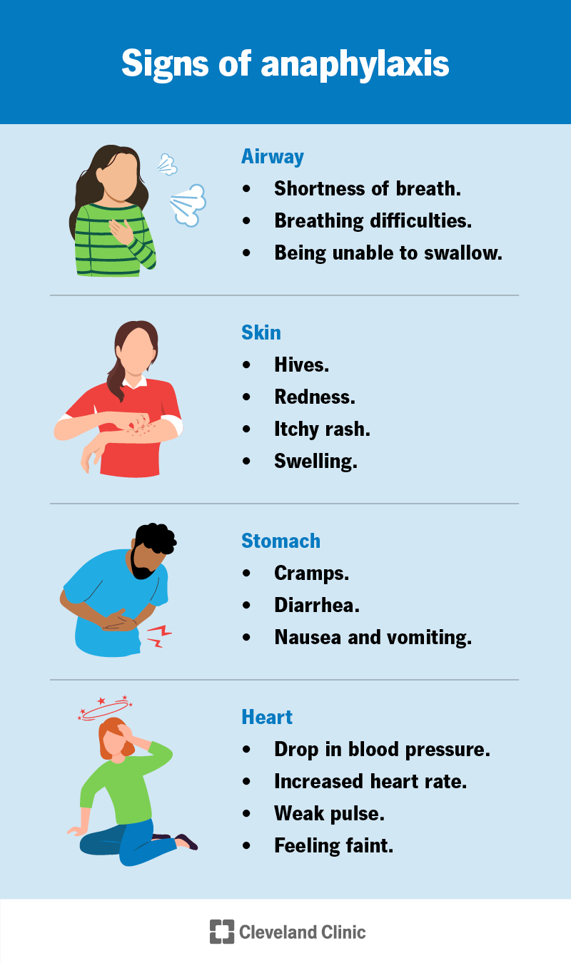 Signs of anaphylaxis include shortness of breath, a drop in blood pressure and swelling in your lips, mouth and throat.