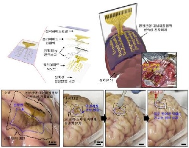 뇌파 측정해 뇌 질환 치료한다…환자 맞춤형 전자약 기술