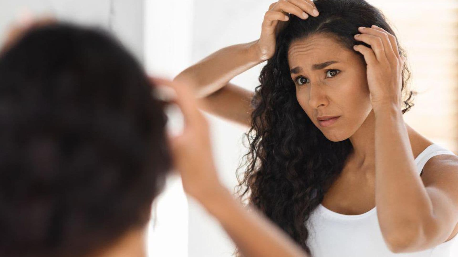 How do you know if it is Dandruff or Seborrheic Dermatitis?