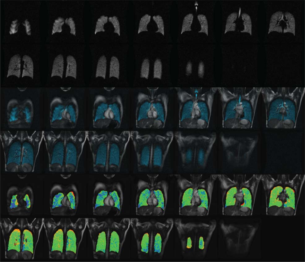 Images of various lungs