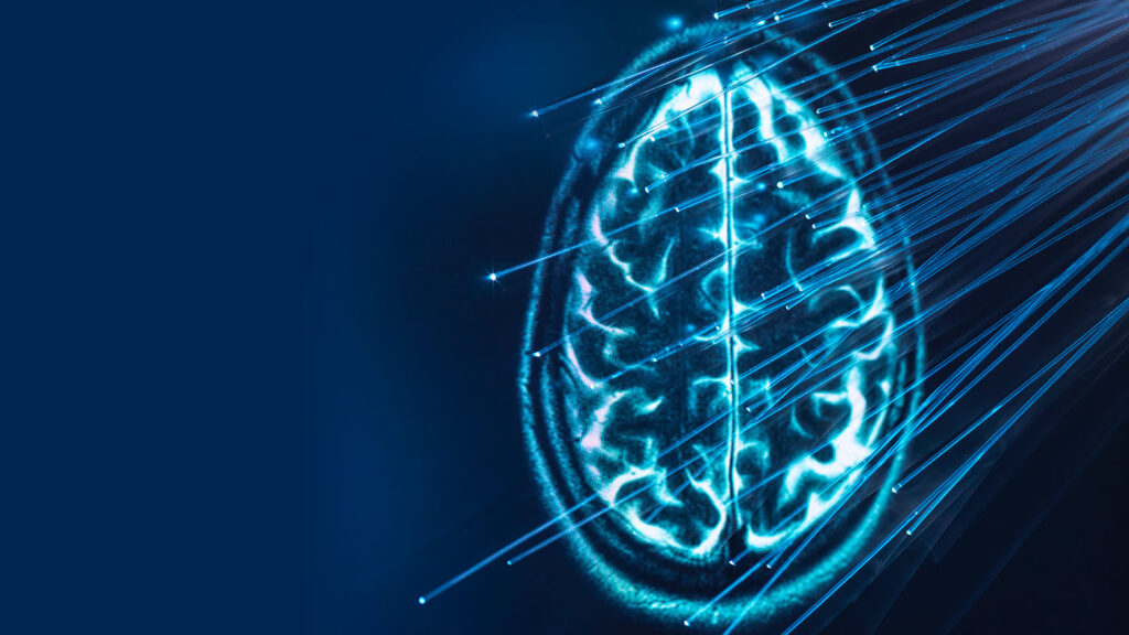 Connected Imaging Instruments: image of a brain scan with a overlay of bright lines