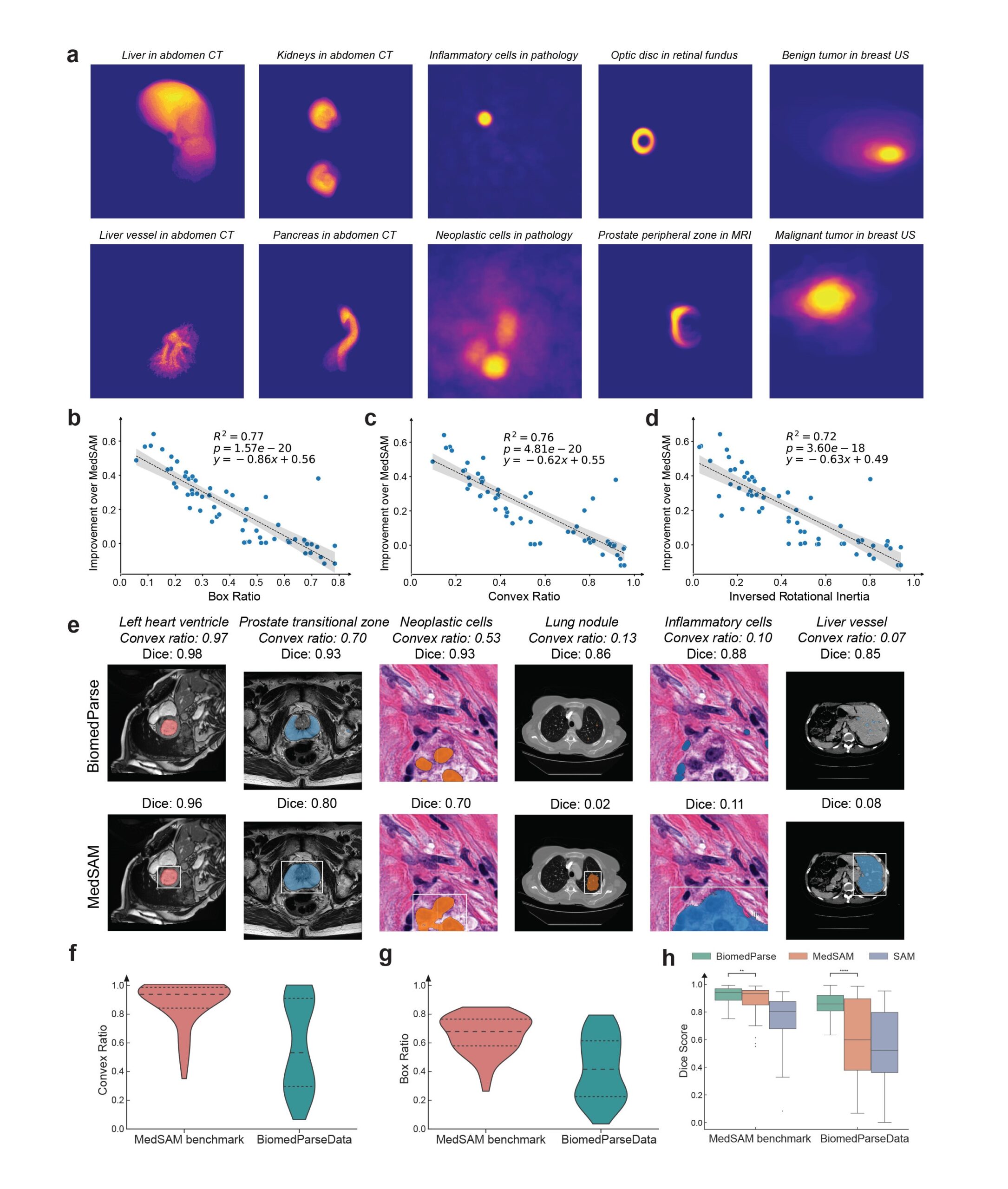 a, Attention maps of text prompts for irregular-shaped objects, suggesting that BiomedParse learns rather faithful representation of their typical shapes. US, ultrasound. b–d, Scatter-plots comparing the improvement in Dice score for BiomedParse over MedSAM with shape regularity in terms of convex ratio (b), box ratio (c) and inversed rotational inertia (d). A smaller number in the x axis means higher irregularity on average. Each dot represents an object type. e, Six examples contrasting BiomedParse and MedSAM on detecting irregular-shaped objects. Plots are ordered from the least irregular one (left) to the most irregular one (right). f,g Comparison between BiomedParseData and the benchmark dataset used by MedSAM in terms of convex ratio (f) and box ratio (g). BiomedParseData is a more faithful representation of real-world challenges in terms of irregular-shaped objects. h, Box plots comparing BiomedParse and competing approaches on BiomedParseData and the benchmark dataset used by MedSAM. BiomedParse has a larger improvement on BiomedParseData, which contains more diverse images and more irregular-shaped objects. The number of object types are as follows: n=50 for MedSAM benchmark and n=112 for BiomedParseData. 